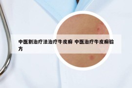 中医割治疗法治疗牛皮癣 中医治疗牛皮癣验方