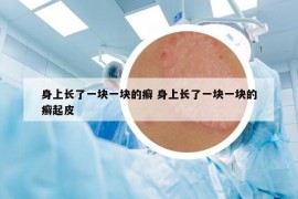 身上长了一块一块的癣 身上长了一块一块的癣起皮