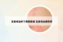 五禽戏治好了我银屑病 五禽戏治病实例