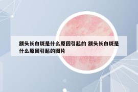 额头长白斑是什么原因引起的 额头长白斑是什么原因引起的图片