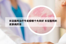 长征医院治疗牛皮癣哪个大夫好 长征医院的皮肤病药膏