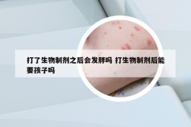 打了生物制剂之后会发胖吗 打生物制剂后能要孩子吗