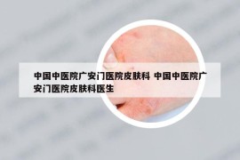 中国中医院广安门医院皮肤科 中国中医院广安门医院皮肤科医生