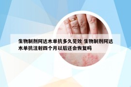 生物制剂阿达木单抗多久见效 生物制剂阿达木单抗注射四个月以后还会恢复吗