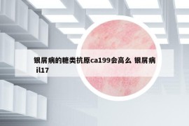 银屑病的糖类抗原ca199会高么 银屑病 il17