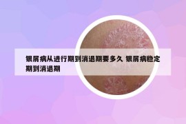 银屑病从进行期到消退期要多久 银屑病稳定期到消退期
