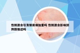 性刺激会引发银屑病加重吗 性刺激会影响到例假推迟吗
