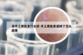 涂手上黑色素什么好 手上黑色素退掉了怎么回事