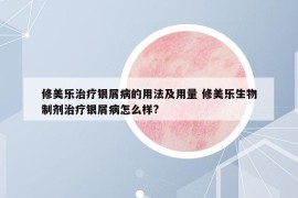 修美乐治疗银屑病的用法及用量 修美乐生物制剂治疗银屑病怎么样?