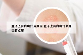肚子上有白斑什么原因 肚子上有白斑什么原因有点痒