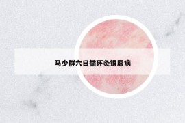 马少群六日循环灸银屑病