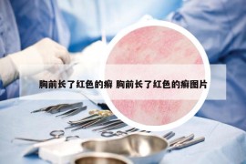 胸前长了红色的癣 胸前长了红色的癣图片