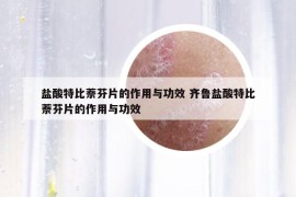 盐酸特比萘芬片的作用与功效 齐鲁盐酸特比萘芬片的作用与功效