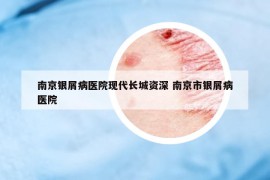 南京银屑病医院现代长城资深 南京市银屑病医院