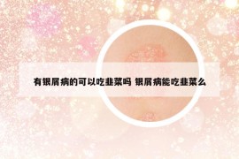 有银屑病的可以吃韭菜吗 银屑病能吃韭菜么