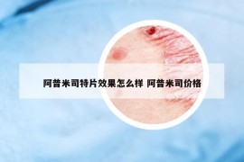 阿普米司特片效果怎么样 阿普米司价格