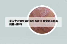 泰安专治银屑病的医院怎么样 泰安银屑病医院花钱贵吗