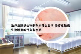 治疗皮肤病生物制剂叫什么名字 治疗皮肤病生物制剂叫什么名字啊