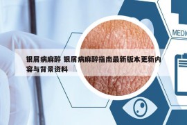 银屑病麻醉 银屑病麻醉指南最新版本更新内容与背景资料
