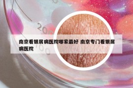 南京看银屑病医院哪家最好 南京专门看银屑病医院
