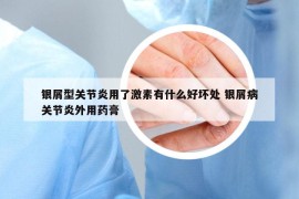 银屑型关节炎用了激素有什么好坏处 银屑病关节炎外用药膏