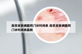 南京皮肤病医院门诊时间表 南京皮肤病医院门诊时间表最新