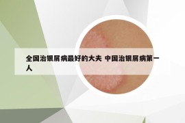 全国治银屑病最好的大夫 中国治银屑病第一人
