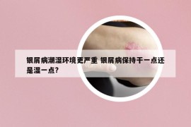 银屑病潮湿环境更严重 银屑病保持干一点还是湿一点?