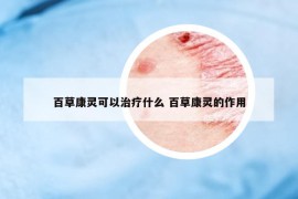 百草康灵可以治疗什么 百草康灵的作用