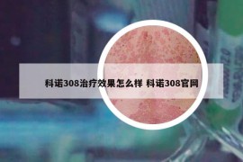 科诺308治疗效果怎么样 科诺308官网