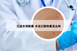 三泊卡淳胶囊 卡泊三醇效果怎么样