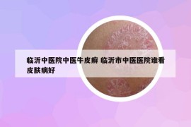 临沂中医院中医牛皮癣 临沂市中医医院谁看皮肤病好