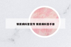 银屑病科普宣传 银屑病科普手册