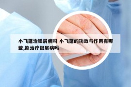 小飞蓬治银屑病吗 小飞蓬的功效与作用有哪些,能治疗银屑病吗