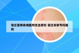 宿迁是银屑病医院优选楚街 宿迁皮肤专科医院