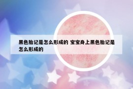 黑色胎记是怎么形成的 宝宝身上黑色胎记是怎么形成的