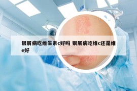 银屑病吃维生素c好吗 银屑病吃维c还是维e好