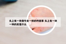 头上有一块像牛皮一样的咋回事 头上有一块一块的皮是什么
