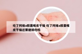 吃了阿维a胶囊嘴皮干燥 吃了阿维a胶囊嘴皮干燥还要继续吃吗