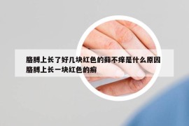 胳膊上长了好几块红色的藓不痒是什么原因 胳膊上长一块红色的癣