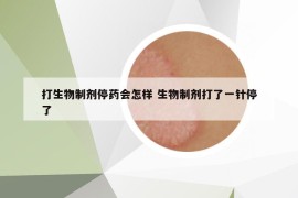 打生物制剂停药会怎样 生物制剂打了一针停了