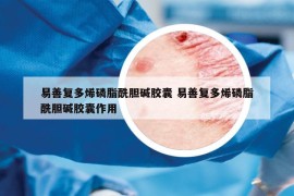 易善复多烯磷脂酰胆碱胶囊 易善复多烯磷脂酰胆碱胶囊作用