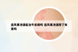 追风果泡酒能治牛皮癣吗 追风果泡酒擦了有害吗