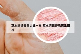 草本消银膏多少钱一盒 草本消银膏陈医生图片