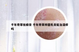 千年奇草祛癣膏 千年奇草抑菌乳膏能治湿疹吗