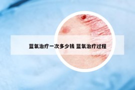 蓝氧治疗一次多少钱 蓝氧治疗过程