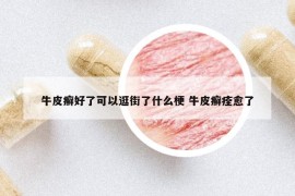 牛皮癣好了可以逛街了什么梗 牛皮癣痊愈了