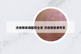 济南银屑病医院全景 济南银屑病专家