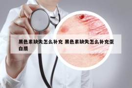 黑色素缺失怎么补充 黑色素缺失怎么补充蛋白质