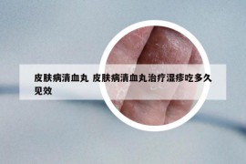 皮肤病清血丸 皮肤病清血丸治疗湿疹吃多久见效